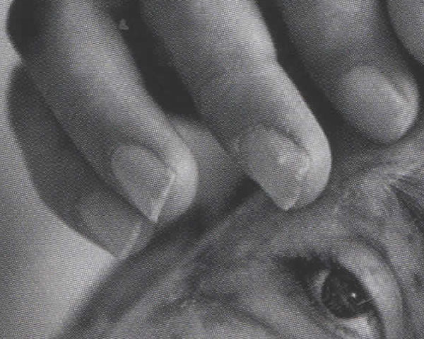 Politics and the Pulitzers